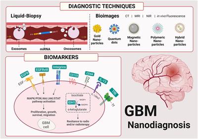Advances in nano-based materials for glioblastoma multiforme diagnosis: A mini-review